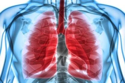 今年体检 查出5个肺癌 全是女性 