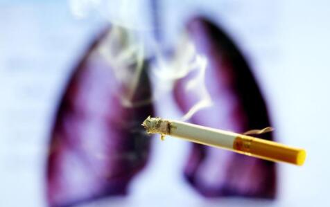 肺癌会有这五个标志 出现这些说明早已不是早期