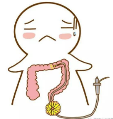 怀疑得了肠道病要做肠镜吗