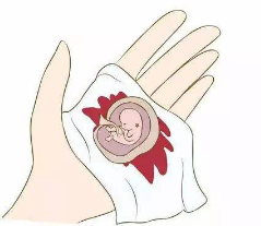 腹中胎儿死亡应该如何处理