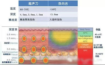 超声刀和热玛吉区别在哪里