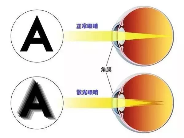 高散光眼镜多少钱一副,高散光眼镜多少钱一副啊