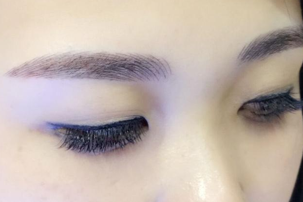上海和睦家医院眉位不正修复后疼吗