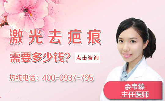 聊城东阿县人民医院激光祛疤痕贵吗