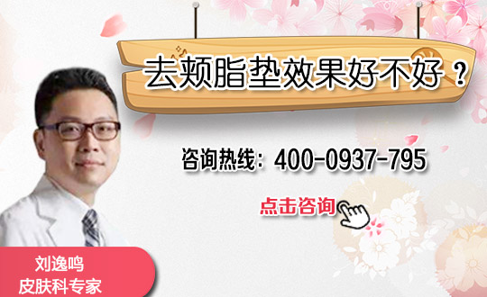 嘉兴中医医院整形去颊脂垫会肿吗 嘉兴中医医院整形去颊脂垫会肿吗