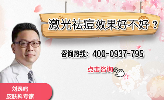 激光祛痘怎么样