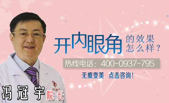 开眼角适应人群有哪些