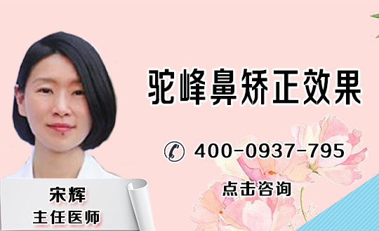 驼峰鼻禁忌症