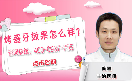 烤瓷牙寿命影响因素
