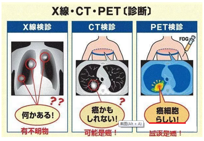 pet-ct