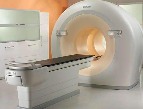 PET-CT是如何挽救早期肺癌患者的？