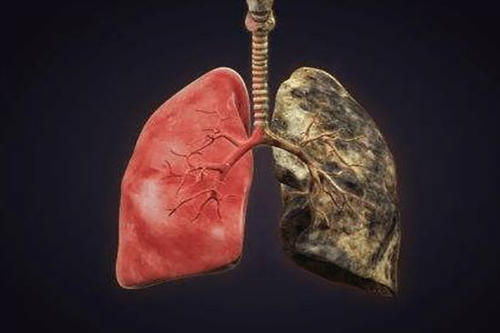 预防肺癌