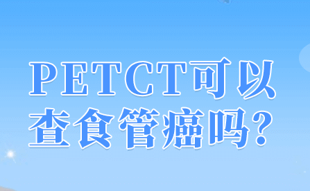 petct检查