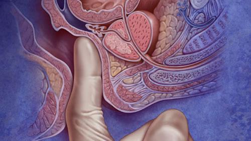 肛管直肠癌有哪些症状表现？