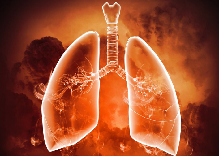 得了肺癌还能活多久？如何肺癌患者延长生命？