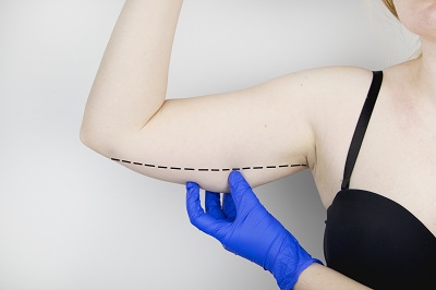 瘦手臂的较快方法做手臂吸脂有哪些副作用及如何规避？