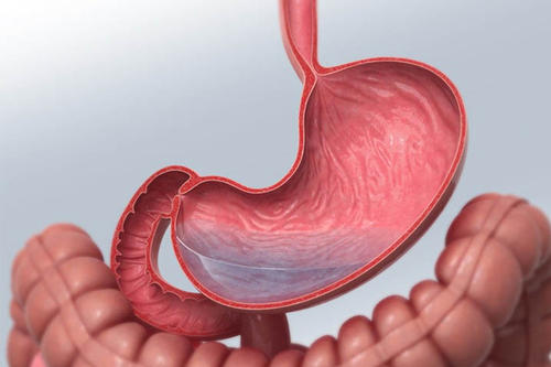胃癌的预后情况受哪些因素影响？