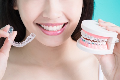 牙套多少钱？牙套决定牙齿矫正的价格吗？