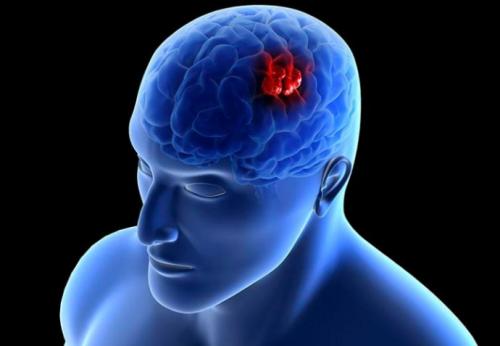 脑胶质瘤可以采用质子重离子治疗吗？