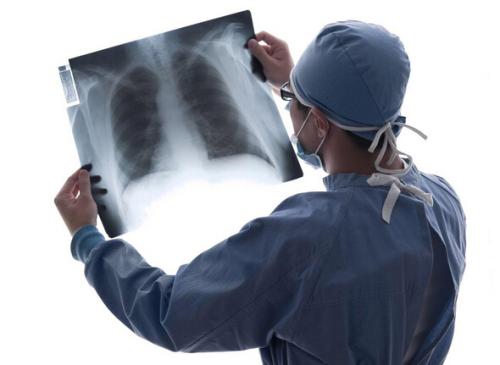 肺癌患者如何科学抗癌？