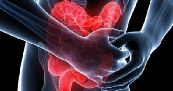 肠道癌的诱发因素有哪些？如何治疗？