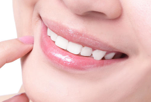 深圳牙齿整形过程是怎样的？一般价格是多少？
