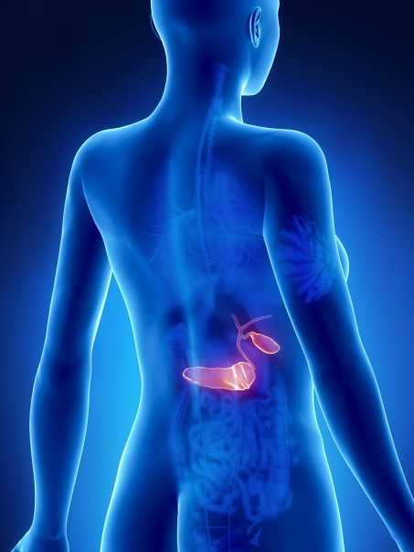 胰腺癌的症状是什么？哪里需要注意？