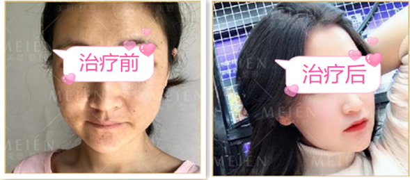 广州美恩