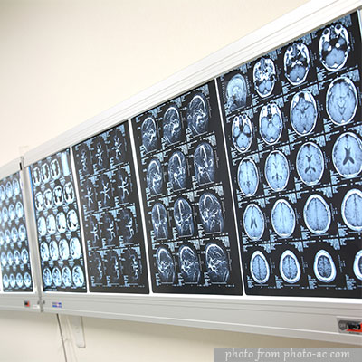 磁共振与PET-CT的区别有哪些？PET-CT优势