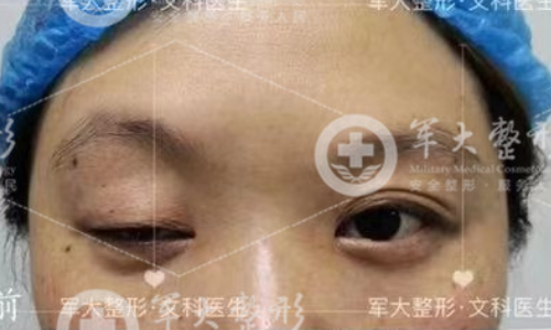 眼