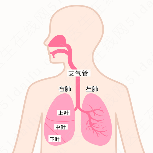 肺 癌 手 术 类 型
