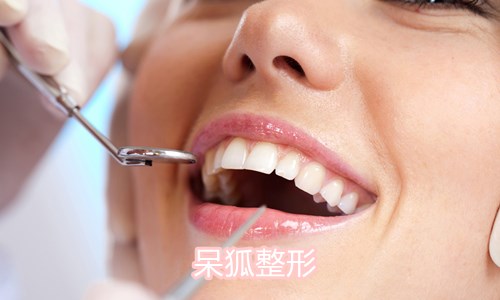 口腔整形