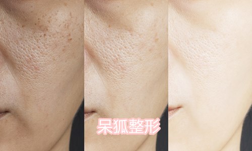 北京云全斯嘉丽