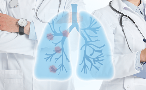 肺癌早期非得手术治疗吗？