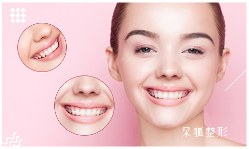 牙科美容属于生活美容吗？上海牙科美容医院哪家好？