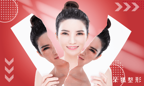 肌肤