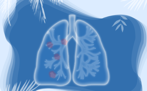 肺结核是怎样长出来的？