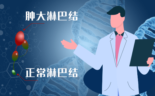 上海市第十人民医院PET-CT中心淋巴癌照PET-CT意义大吗？