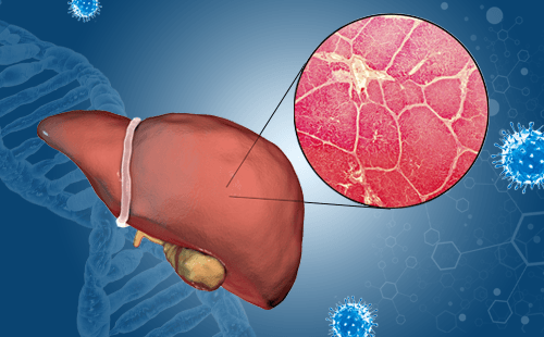 胰腺癌有多危险？如何通过生活方式预防胰腺癌？