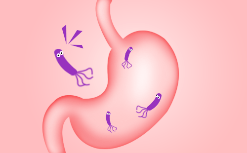 幽门螺旋杆菌是什么？它与胃癌有联系吗？