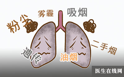 肺结节就是肺癌吗？肺癌的症状有哪些？