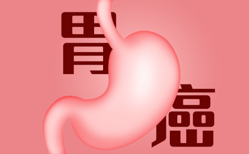 胃癌会遗传给孩子吗？胃癌会传染吗？