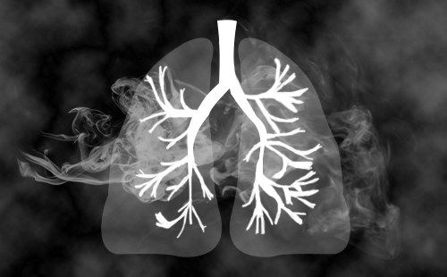 肺癌患者进行早筛 对肺癌检测有73%灵敏度和90%特异性