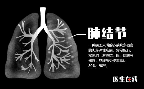 有了肺结节就一定是肺癌了吗？磨玻璃样结节就是肺癌了吗？