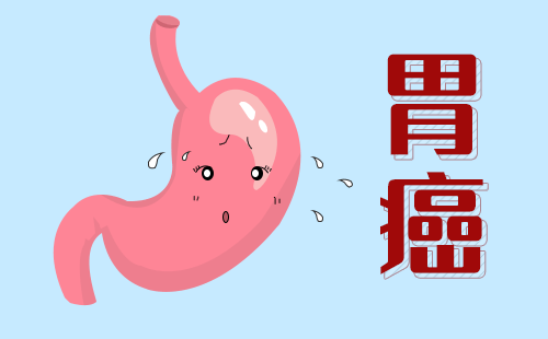80%的中国人都感染力幽门罗肠杆菌，阳性的幽门罗肠杆菌会发展成胃癌吗？