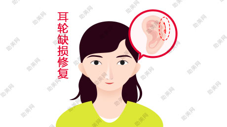 烧伤耳的修复都有哪些方法
