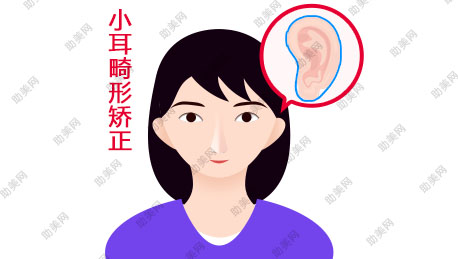 武汉春语小耳畸形矫正后护理？