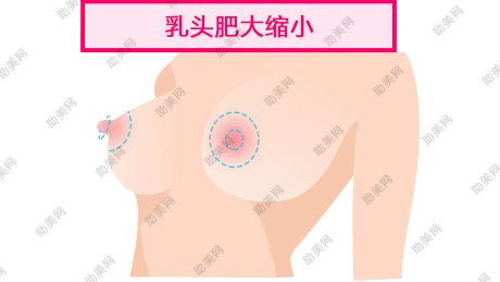 武汉中心医院乳头缩小后怎么护理