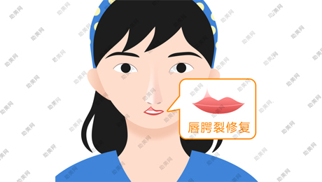 唇裂修复可能出现的副作用是什么？