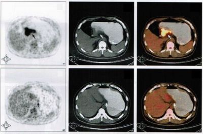 petct-20111104-sun-01.jpg